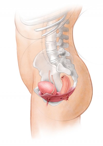 medical illustration, anatomical illustration, female anatomy pictures, botox injection sites